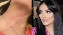 فن